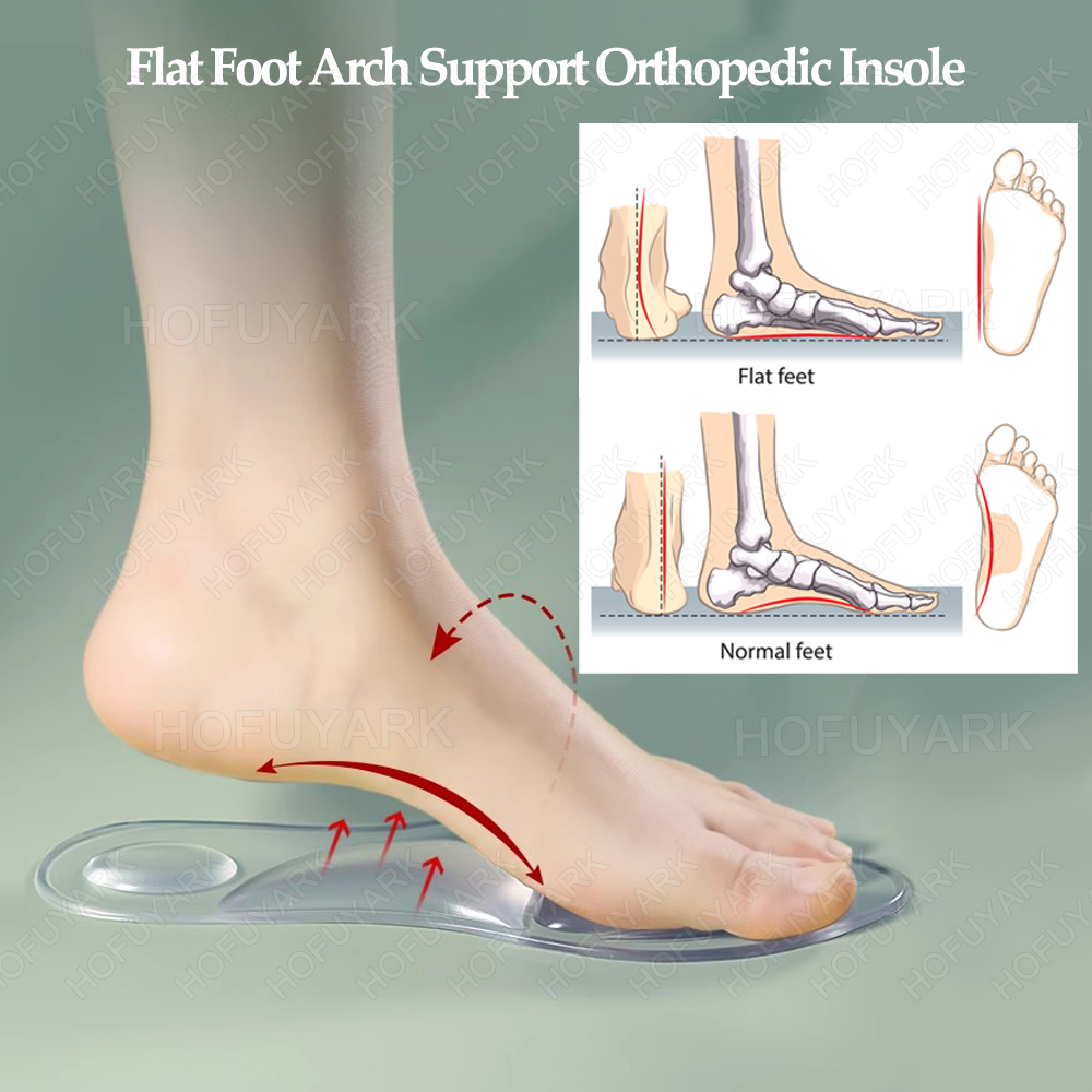 Silicone Gel Insoles Orthopedi - Women'S Shoes High Arch Support recensie en prijs